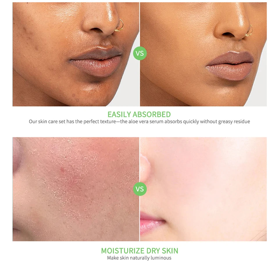 Multi-skin Care Aloe Vera Skin Care Set Deep Moisturizing