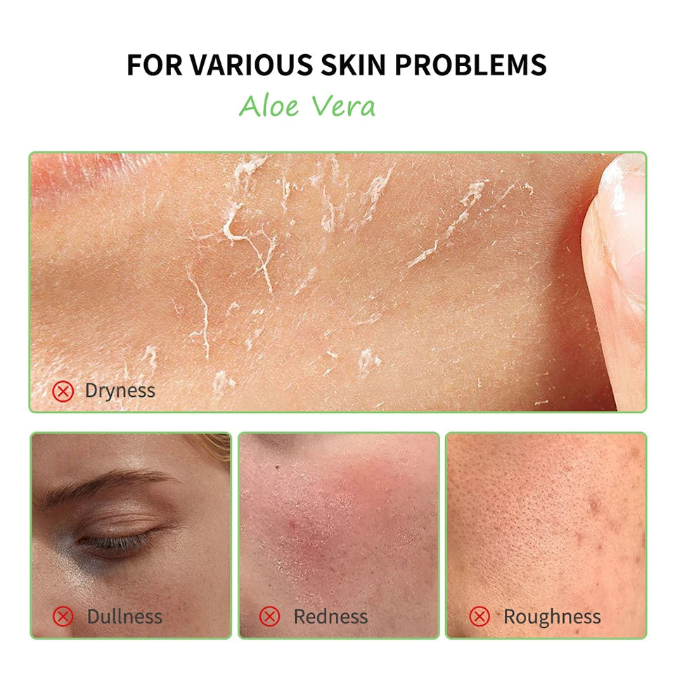 Multi-skin Care Aloe Vera Skin Care Set Deep Moisturizing