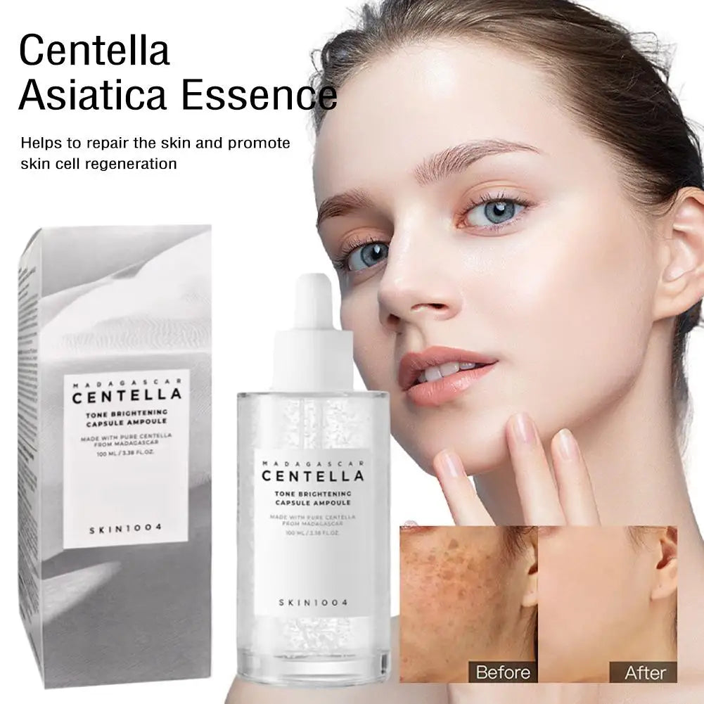 Centella Asiatica Serum 100ml Deep Hydration & Moisturizing Repair Soothes Breakouts Pink Salt Essence Korean Skincare