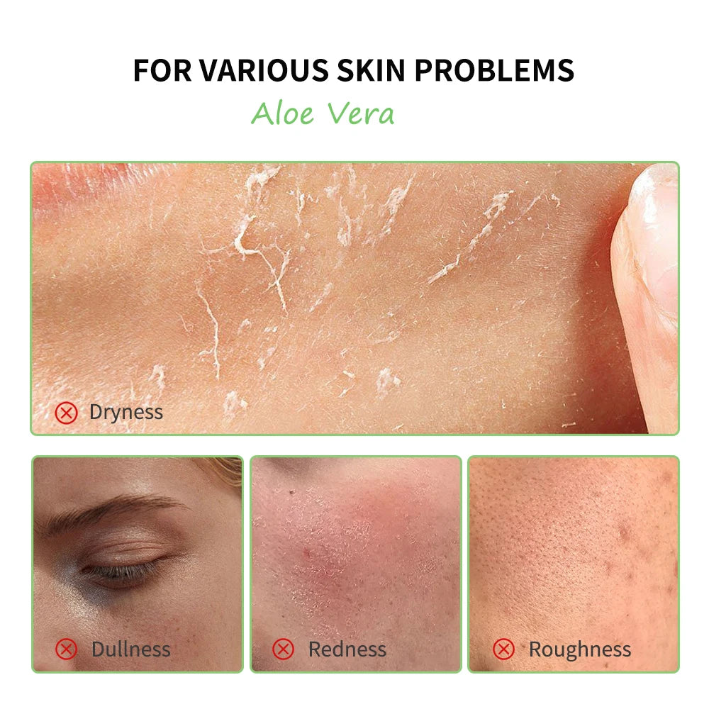 Multi-skin Care Aloe Vera Skin Care Set Deep Moisturizing