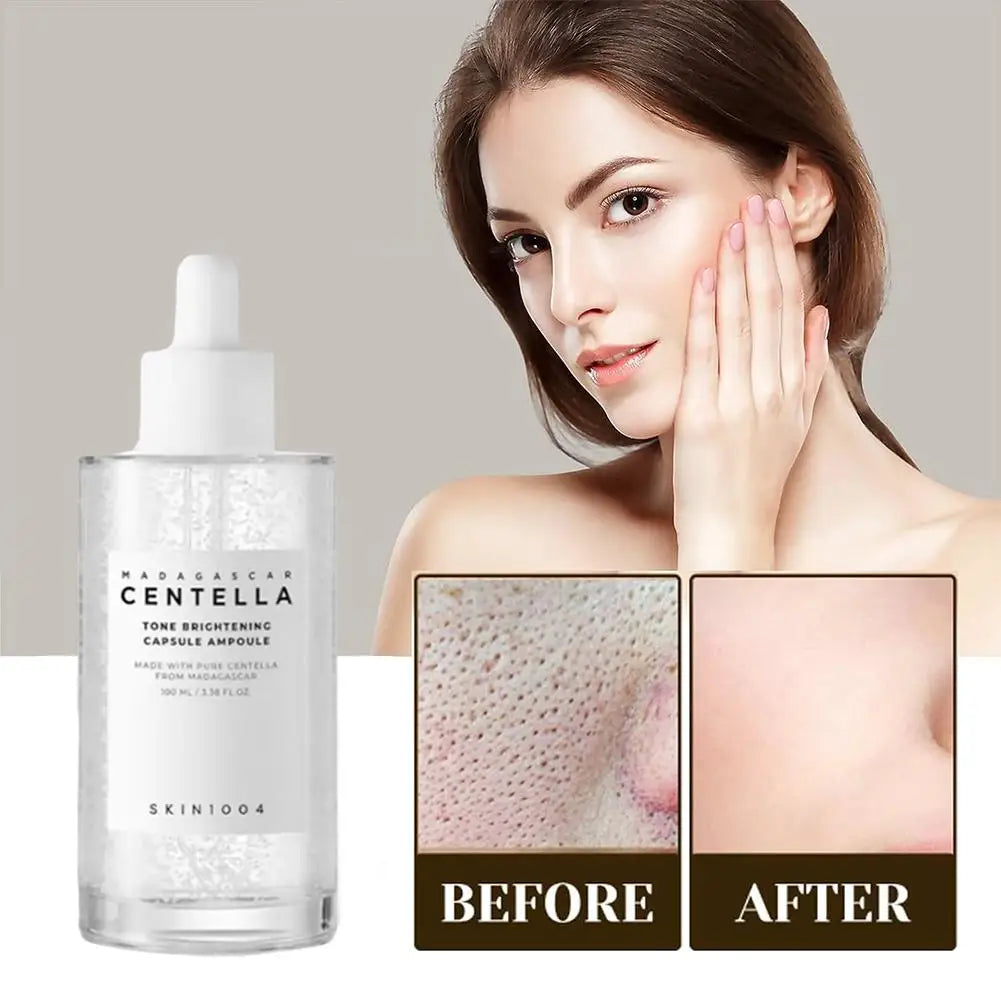 Centella Asiatica Serum 100ml Deep Hydration & Moisturizing Repair Soothes Breakouts Pink Salt Essence Korean Skincare